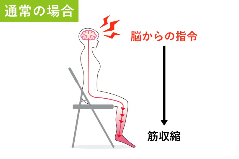 通常の場合